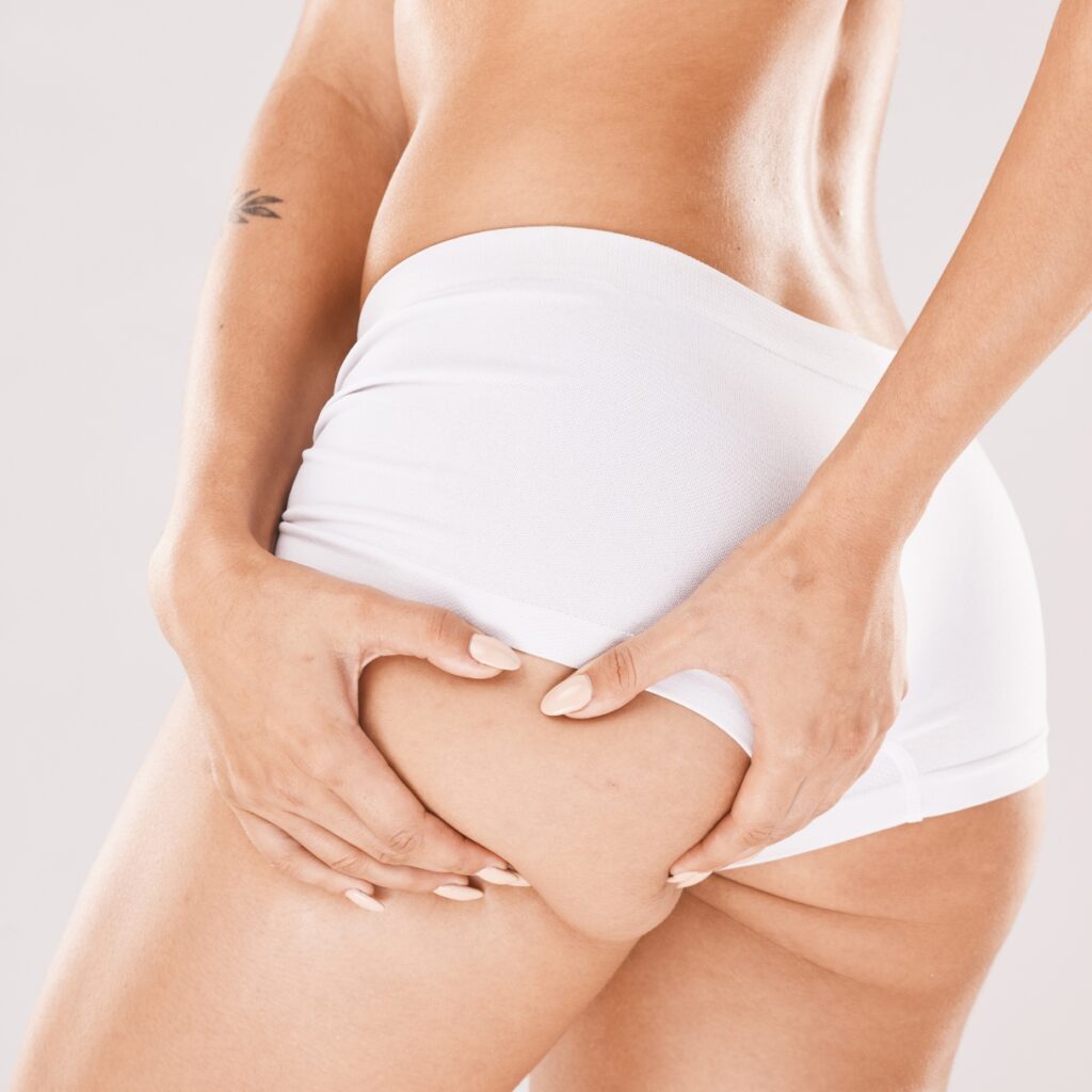 Who Can Benefit from a Brazilian Butt Lift