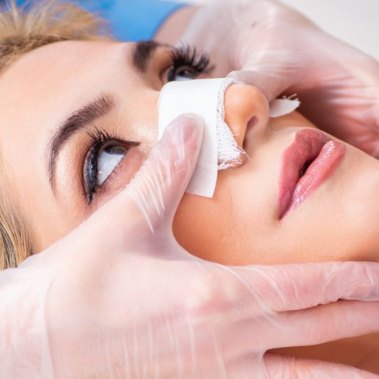 Can I Fly After Rhinoplasty Travel Advice for International Patients