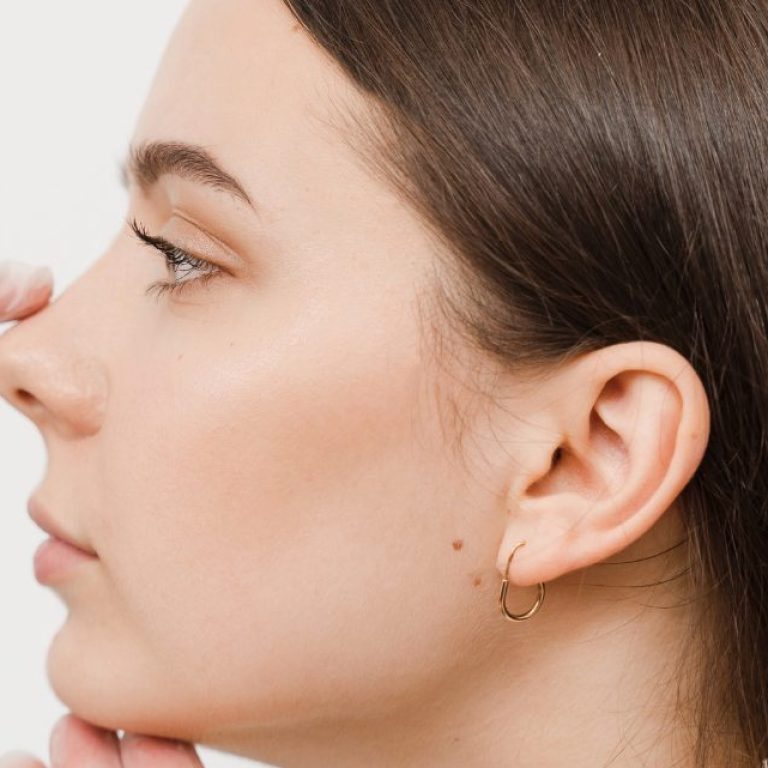 Closed vs Open Rhinoplasty