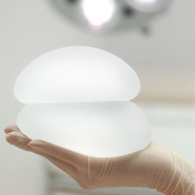 What Happens If You Don’t Replace Breast Implants